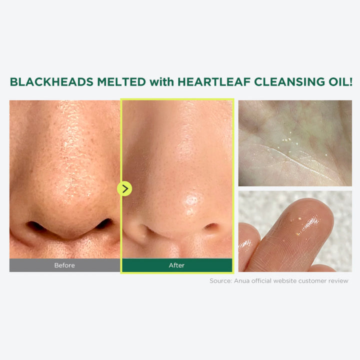 ANUA Heartleaf Pore Control Cleansing Oil for Sensitive Skin & Blackhead Removal in Kuwait – Beutista - pores